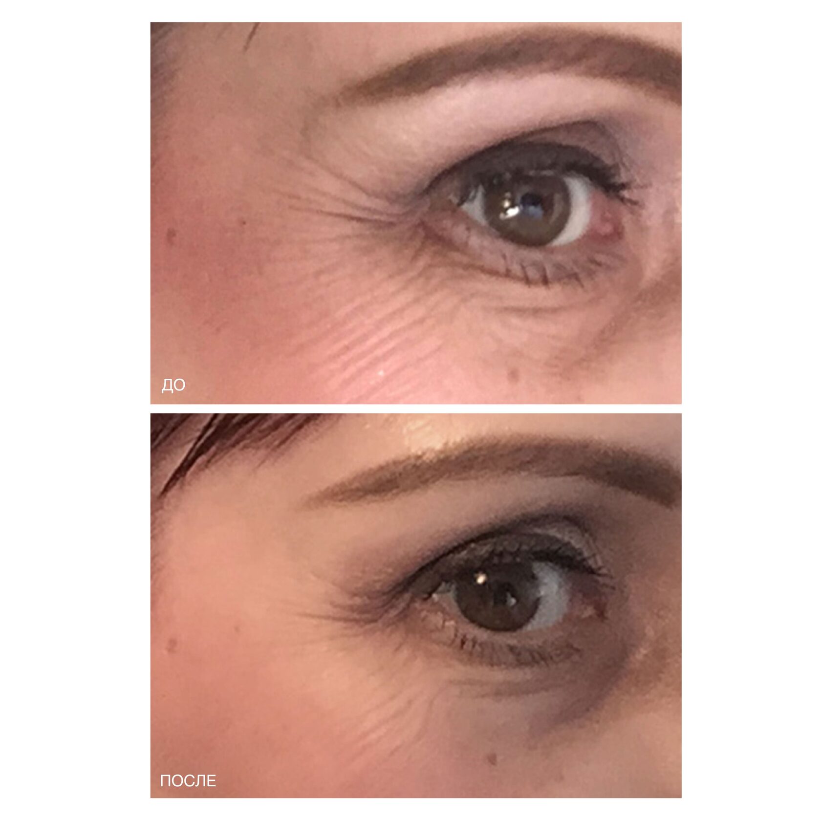 DNA RENEWAL TREATMENT — ДНК-протектор