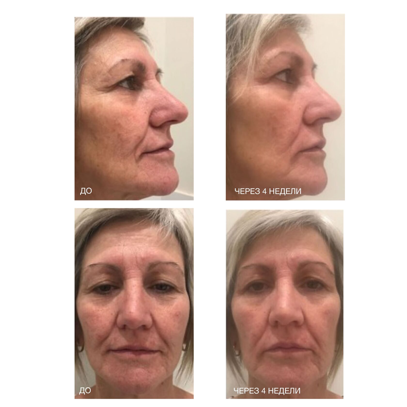 DNA RENEWAL TREATMENT — ДНК-протектор